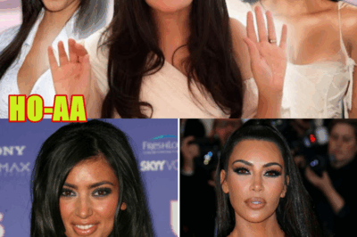 “Kim Let’s North Get RISKY Cosmetic Procedure | This Is REALLY BAD”