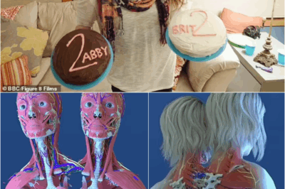 S – Fans left stunned as conjoined twins Abby and Brittany Hensel reveal how their bodies are really connected