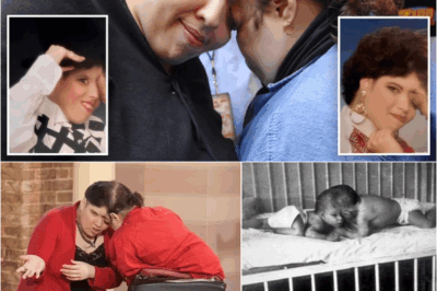 S – World’s oldest conjoined twins, Lori and George Schappell, dead at 62