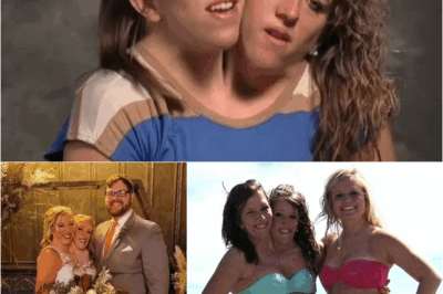 S – ‘SO PRETTY’  Conjoined twins Abby and Brittany, 34, praised for beach bikini photo after wedding joy