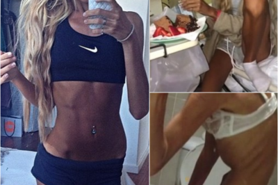 S – ‘My obsession with Miranda Kerr turned me into an anorexic on death’s door’