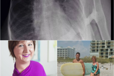 S – ‘I’m becoming a human statue’: Woman with rare condition that’s turning her muscles to bone