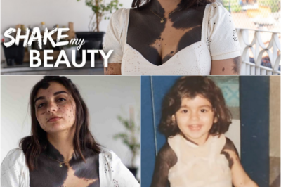 S – I’m 80% Covered In Birthmarks: The Extraordinary Journey of Beatriz Pugliese