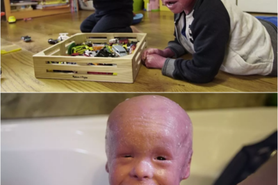 S – Boy, 5, has skin that grows 10 TIMES normal rate – leaving him with scales across his body
