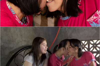 S – The Incredible Conjoined Twins Attached at the Head: Joy and Joyce’s Journey of Hope